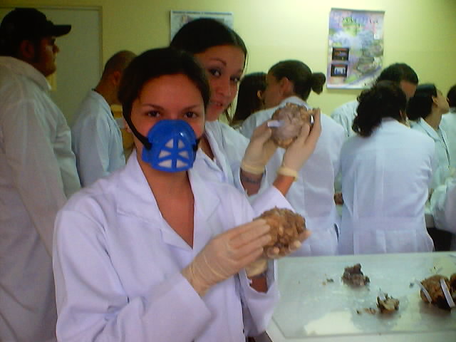 would you like a piece of brain?